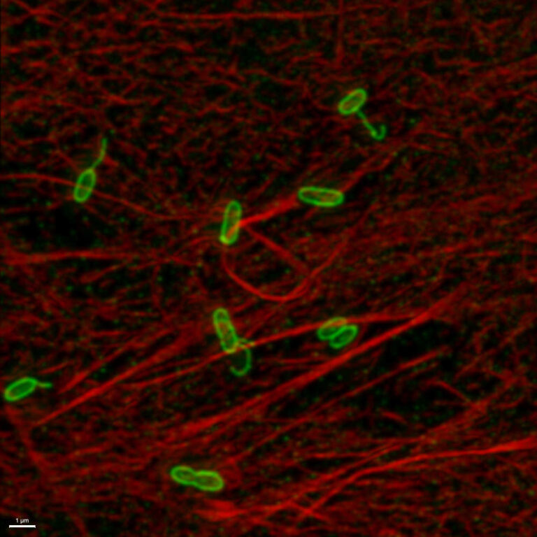 IOM122 2024 bacteria pili