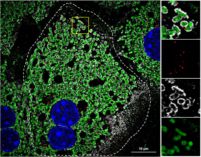 Image of the month for January 2025, featuring a mammalian cell imaged using Lattice SIM