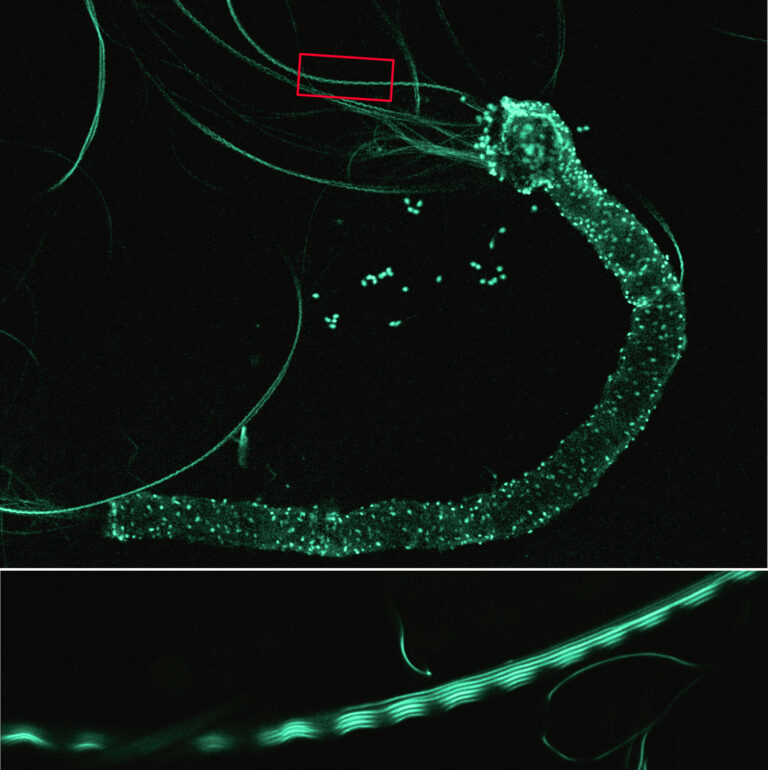 IOM0525 confocal image of carabid beetle spermatostyles