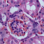 Section through a mouse kidney showing a glomerulus stained with Mayer's Hematoxylin and Eosin. Imaged using 100x objective. Sample by Lan Mai.
