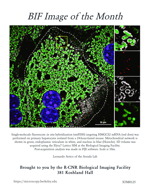 Image of the month for January 2025, featuring a mammalian cell imaged using Lattice SIM